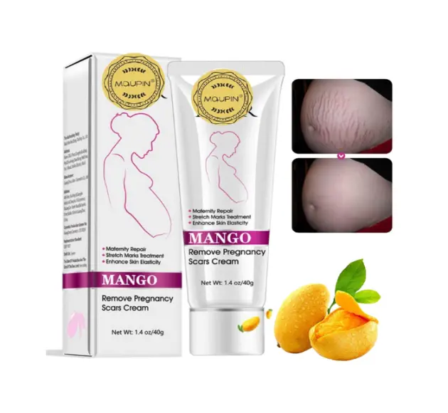 Rtopr Mango Stretch Mark Cream in Pakistan